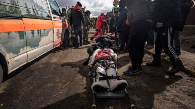 ООН: с начала войны в Украине погибли 516 мирных жителей