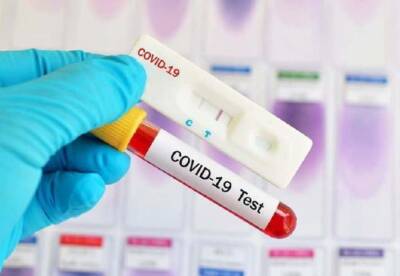 В Одесской области два дня подряд нет новых случаев коронавируса | Новости Одессы