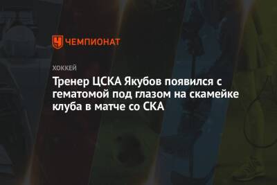 Тренер ЦСКА Якубов появился с гематомой под глазом на скамейке клуба в матче со СКА