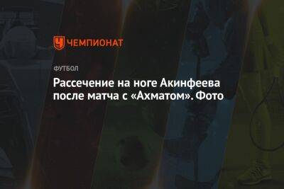 Рассечение на ноге Акинфеева после матча с «Ахматом». Фото