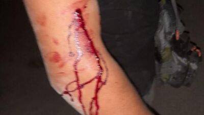Линч в Акко: толпа арабских подростков резала и избивала двоих евреев