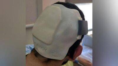 Впервые: израильские врачи восстановили разбитую голову жертвы теракта с помощью напечатанного шлема