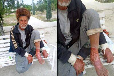 Бездомному мужчине в городе Абадан требуется медицинская помощь