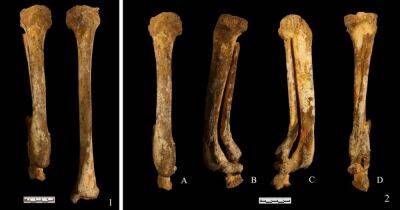 Почти 3000 лет. Археологи нашли свидетельства самой старой ампутации стопы в мире
