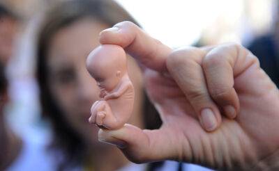 В Узбекистане в прошлом году было сделано свыше 35 тысяч абортов
