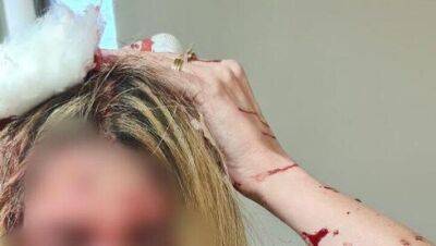 Пациент разбил голову женщине-врачу в Беэр-Яакове за просьбу выйти из кабинета