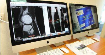 В Больнице травматологии и ортопедии открыт первый в Латвии Центр костной диагностики