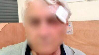 Посигналил на светофоре: в Ришон ле-Ционе жестоко избит 80-летний переживший Катастрофу