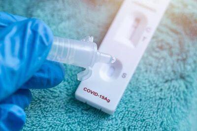 С 30 июня тест на коронавирус будет стоить три евро