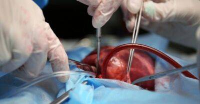 В Латвии успешно проведена первая в этом году трансплантация сердца