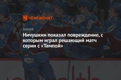 Ничушкин показал повреждение, с которым играл решающий матч серии с «Тампой»