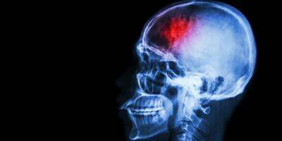 Ковид увеличивает вероятность развития трех опаснейших болезней мозга - nv.ua - США - Украина - Дания