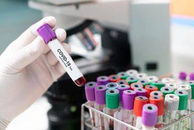 Трое заражённых новым подвидом коронавируса выявлены в Бен-Гурионе