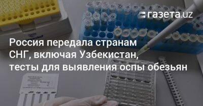 Россия передала странам СНГ, включая Узбекистан, тесты для выявления оспы обезьян