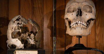 Ученые рассказали, что происходит с зубами после смерти человека