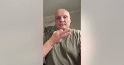 Потерял пальцы и часть стопы: профессор из-под Киева рассказал о пытках в плену (фото)