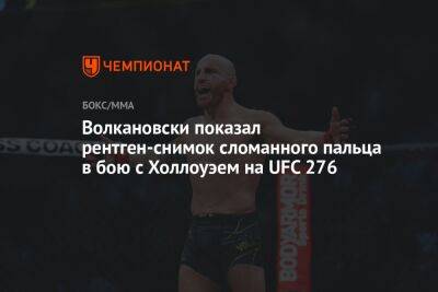 Волкановски показал рентген-снимок сломанного пальца в бою с Холлоуэем на UFC 276