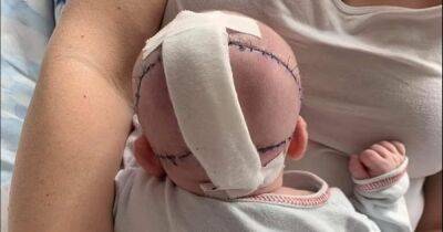 Нарастили череп: в Польше ребенку спасли жизнь, сделав уникальную операцию (фото)