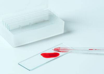 Исследователи научились менять группу крови в почках — это (потенциально) позволит ускорить трансплантацию органов - itc.ua - Украина - Англия