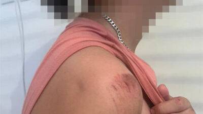 Подростки в Петах-Тикве избили сверстника с особыми потребностями