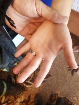 В Ошмянском районе спасатели помогли ребенку снять застрявшее на пальце кольцо