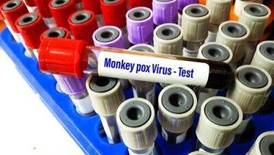 Невероятно: мужчина одновременно заразился оспой обезьян, коронавирусом и ВИЧ