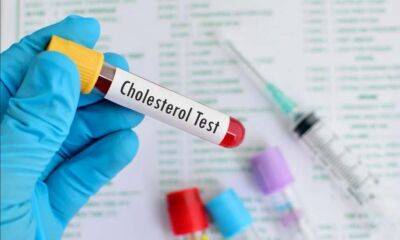 Медики назвали головну ознаку високого холестерину - lenta.ua - Украина