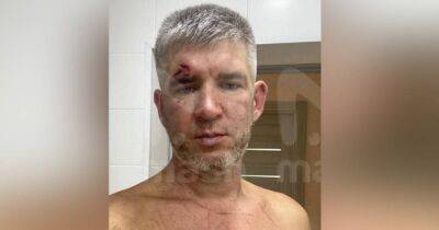 Сковородой по голове: крымчанка избила мужа за поддержку войны в Украине (фото)