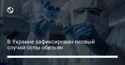 В Украине зафиксирован первый случай оспы обезьян