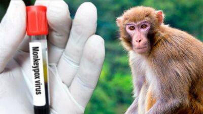 В Україні виявили перший випадок віспи мавп