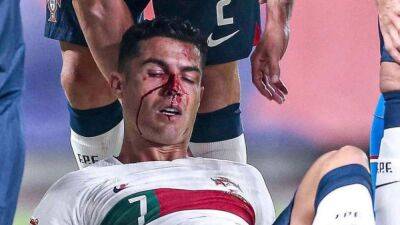 Роналду разбили нос на футбольном поле: видео кровавого инцидента