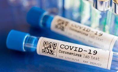 У федерального канцлера положительный результат теста на коронавирус