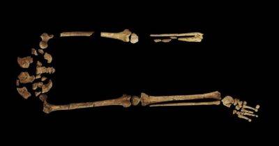 Еще 31 000 лет назад: в Борнео обнаружили свидетельства самой ранней ампутации в мире (фото)