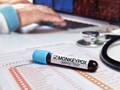 В Украине нет зафиксированных случаев обезьяньей оспы – Минздрав - koronavirus.center - Украина