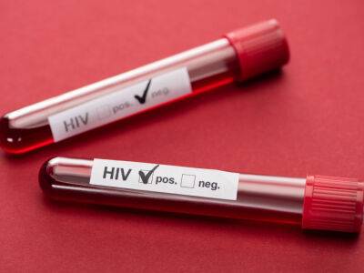 Верховная Рада внесла изминения в закон о профилактике и лечении ВИЧ-инфекции в соответствии с директивами ВОЗ