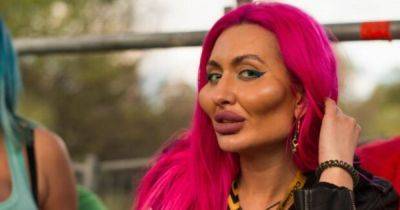Украинка с "самыми большими в мире щеками" повергла фанатов в шок своим внешним видом (фото)