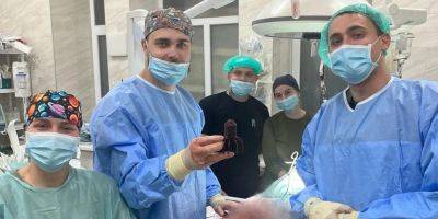 Медики спасли ногу раненому бойцу, достав из нее хвостовик мины - nv.ua - Россия - Украина - Мина