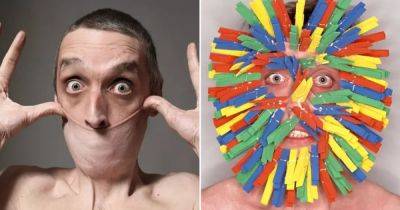 Может натянуть кожу с шеи на рот: рекордсмен Книги рекордов Гиннеса имеет редкое заболевание (фото)