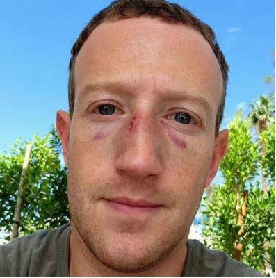 Цукерберг опубликовал фото с избитым лицом на фоне слухов о бое с Илоном Маском