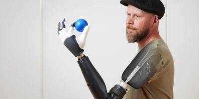 Уникальная технология. В Швеции создали протез, который позволяет двигать всеми пальцами по отдельности с помощью нервов