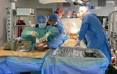 С начала года в Украине проведено более 400 пересадок органов