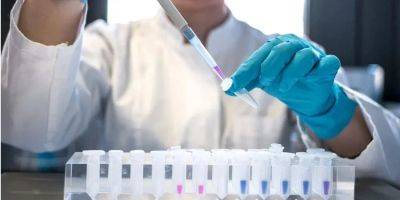 В Ивано-Франковской области обнаружили случаи заражения гепатитом А, семь человек госпитализированы