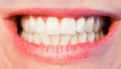 Зубы могут начать крошиться: какие продукты разрушают зубную эмаль