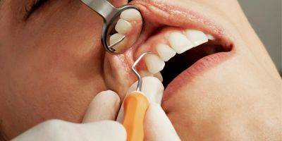 Топ-5 вещей, которые стоматологи советуют избегать любой ценой. Да, это золотые правила здоровой улыбки