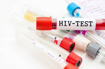 В Одессе и области можно пройти тест на ВИЧ | Новости Одессы