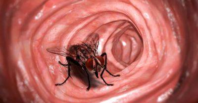 Загадка для врачей: живую жужжащую муху обнаружили в желудке человека (фото)
