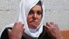 Террористка с обожженным лицом: мировые СМИ нашли себе палестинскую героиню