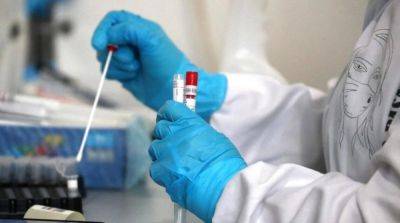 В МОЗ назвали количество случаев гепатита в Винницкой и еще четырех областях