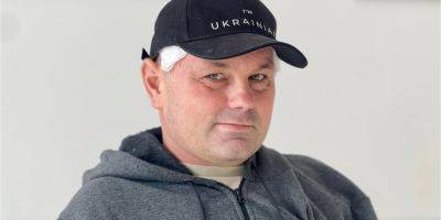 Потерял часть черепа. Пуля прошла сквозь мозг украинского военного, но мужчина чудом выжил — история защитника