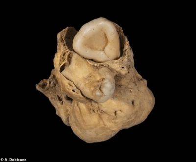 В Египте в гробнице нашли опухоль яичника с зубами - фото